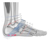 Kompressionsstrumpor PF8 Active för plantarfasciit och hälsporre