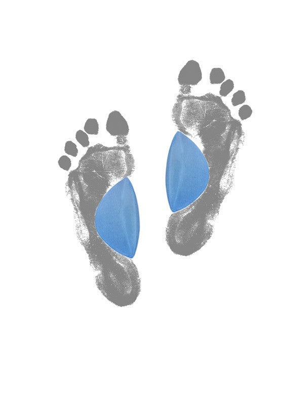 Valvstöd för hålfoten