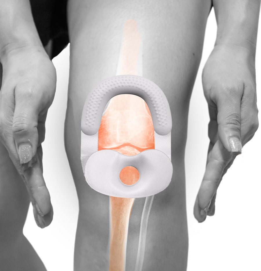 Knäskydd MB Schlatter (Small)
