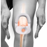 Knäskydd MB Schlatter (Small)